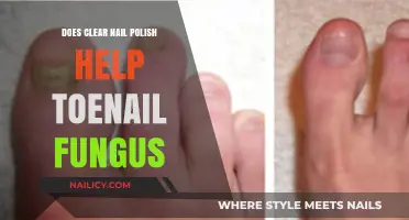 Clear Nail Polish for Toenail Fungus: Effective Remedy or Myth?