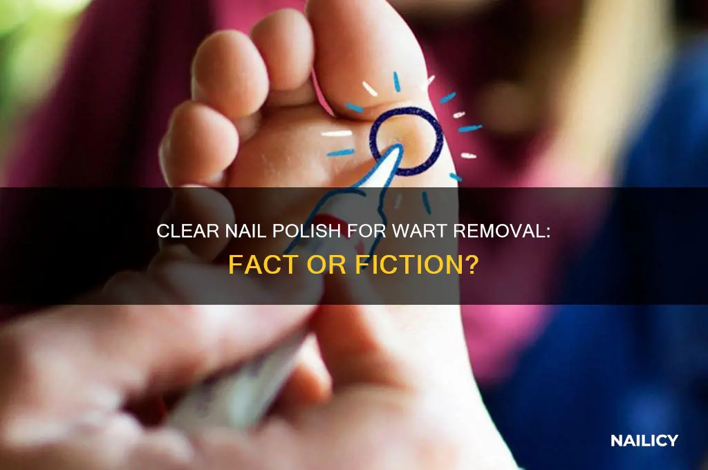 does clear nail polish kill warts