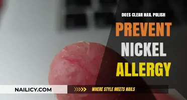 Clear Nail Polish: A Nickel Allergy Solution or Myth?