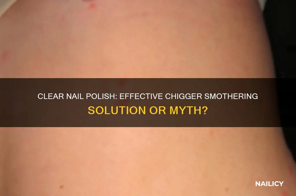does clear nail polish smother chiggers
