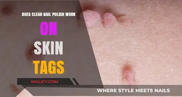 Clear Nail Polish for Skin Tags: Effective Solution or Myth?