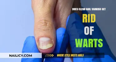 Debunking Myths: Can Clear Nail Varnish Really Cure Warts?
