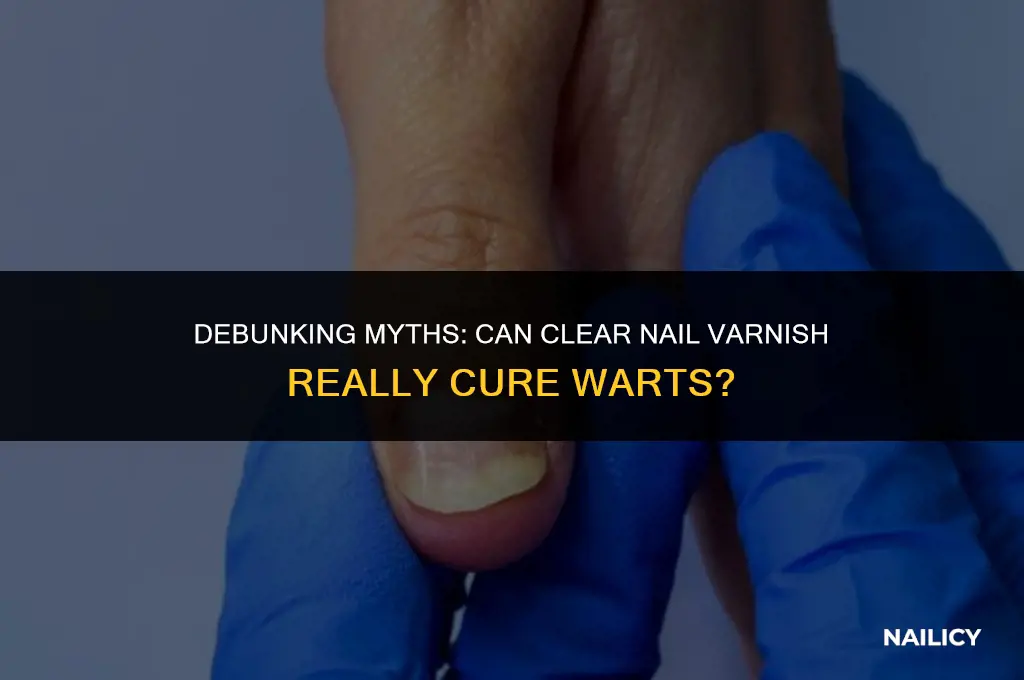 does clear nail varnish get rid of warts