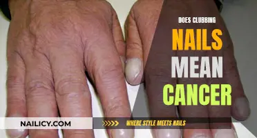 Clubbing Nails: Unraveling the Myth of Cancer Risk