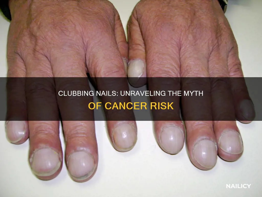 does clubbing nails mean cancer