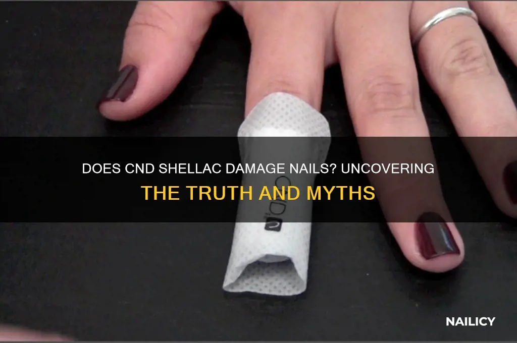 does cnd shellac damage nails