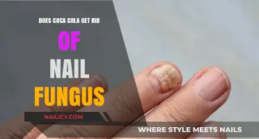 Coca-Cola Cure? Busting Myths About Nail Fungus Remedies