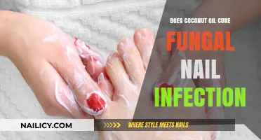 Coconut Oil for Fungal Nail Infections: Myth or Effective Remedy?