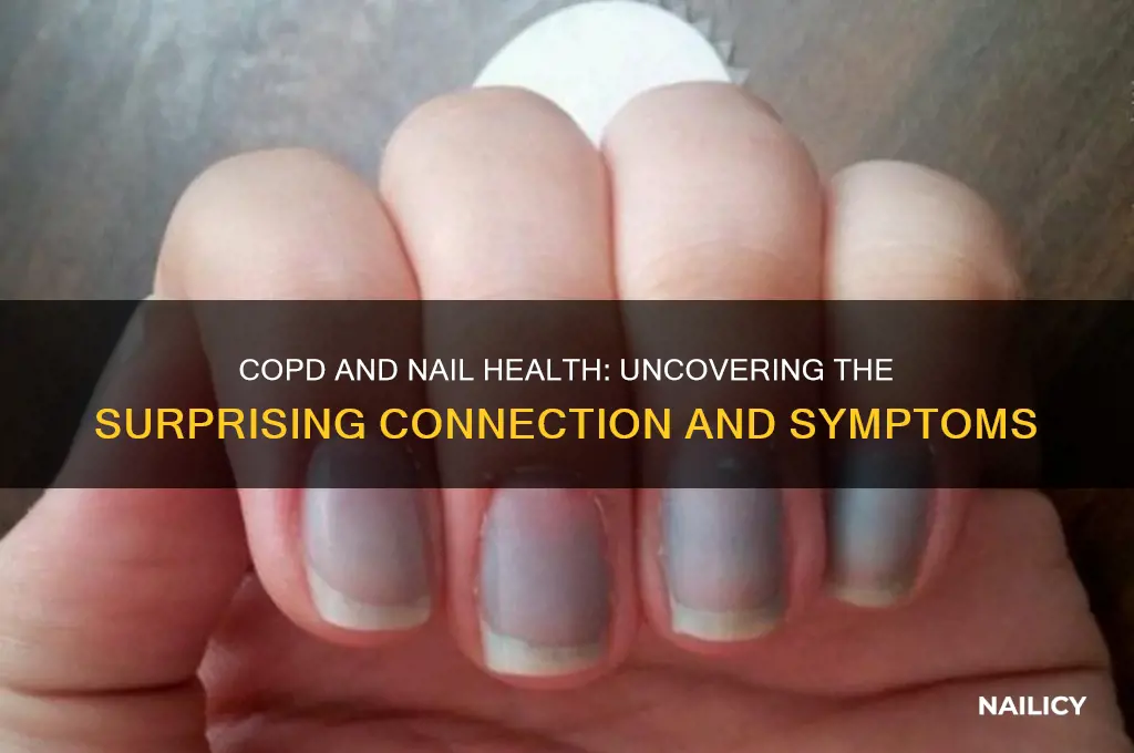 does copd affect your nails