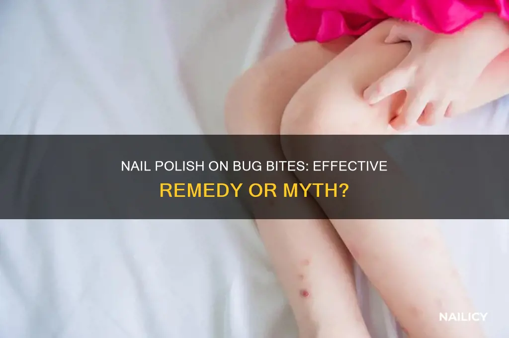 does covering bug bites with nail polish help