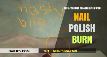 Does Nail Polish on Chigger Bites Cause Burning? Facts Revealed