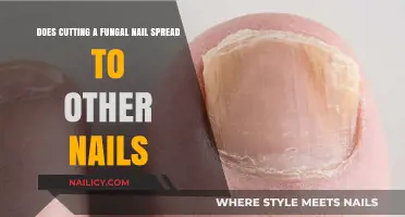 Fungal Nail Trimming: Can It Spread the Infection?