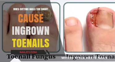 Toenail Trauma: Short Nails and Ingrown Nails