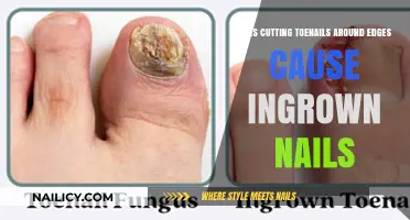 Toenail Cutting Techniques: Preventing Ingrown Nails