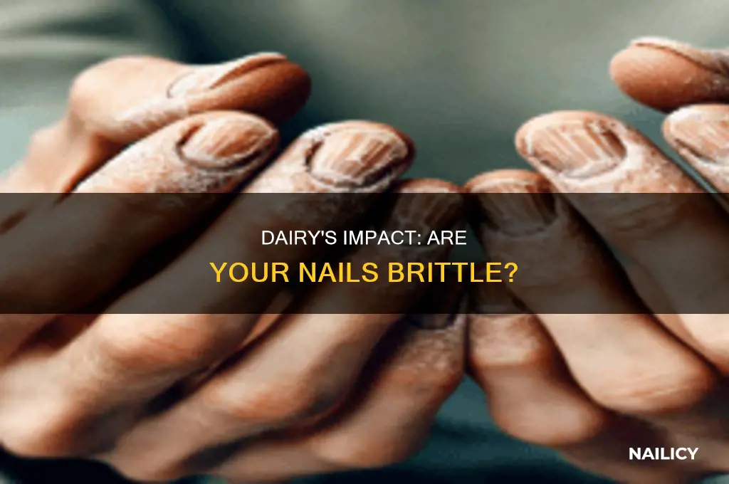 does dairy make your nails brittle