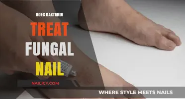 Can Daktarin Effectively Treat Fungal Nail Infections? Expert Insights