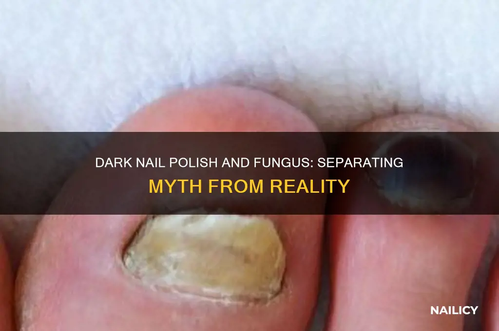 does dark nail polish cause fungus