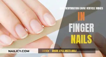 Unraveling the Mystery: Dehydration's Impact on Finger Nail Vertices