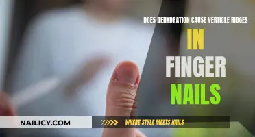 Dehydration and Nails: Vertical Ridges and Their Causes