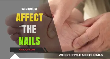 Diabetes and Nail Health: Uncovering the Surprising Connection and Effects