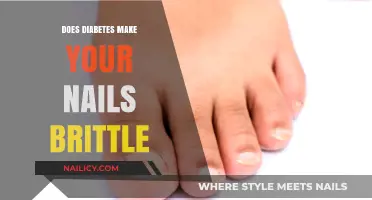 Diabetes and Brittle Nails: Understanding the Connection and Care Tips