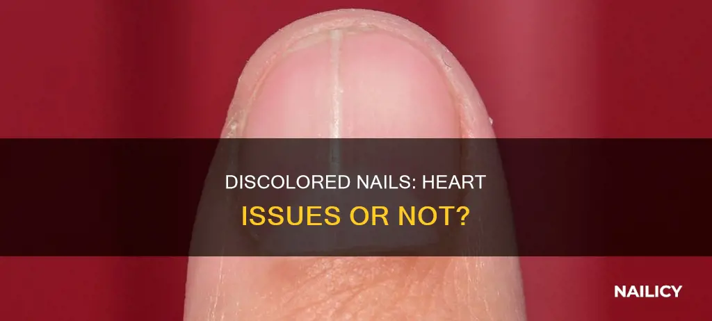 does discolored nails on ring finger mean hart issues