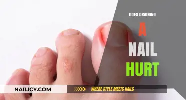 Does Draining a Nail Hurt? Pain, Process, and Recovery Explained