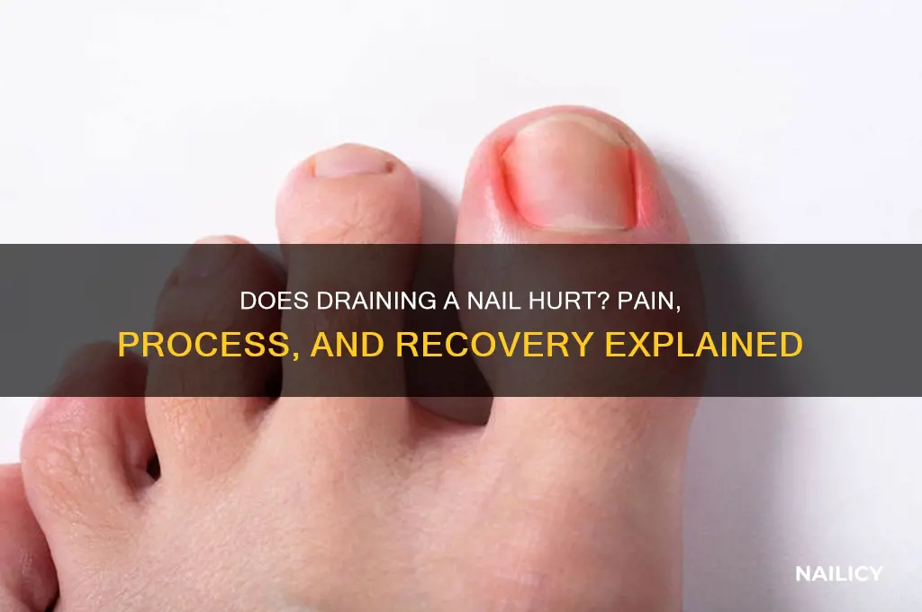 does draining a nail hurt
