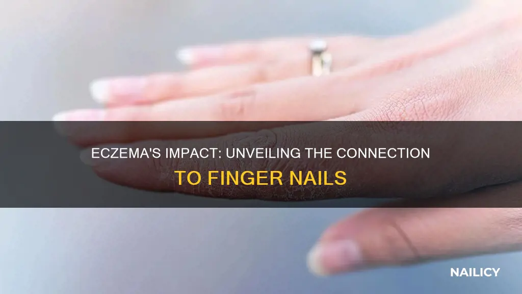 does eczema effect finger nails