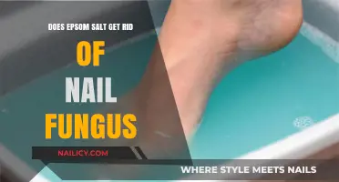 Epsom Salt Soak: A Natural Remedy for Nail Fungus?