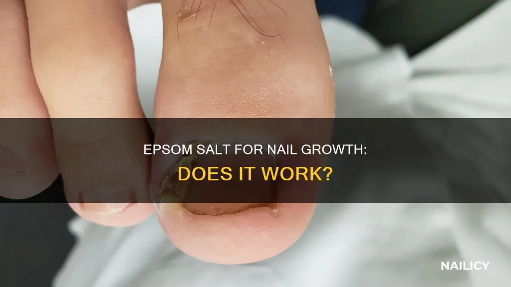 does epsom salt grow nails