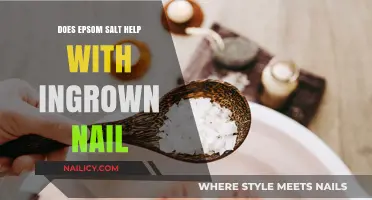 Epsom Salt for Ingrown Nails: Effective Remedy or Myth?