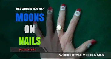 Do All Nails Show Half Moons? Uncovering the Truth Behind Lunulae