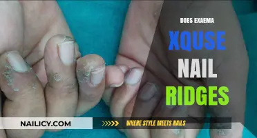 Can Exaema Xquse Smooth Out Nail Ridges? A Detailed Review