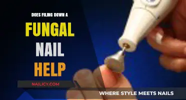 Filing Down Fungal Nails: Effective Treatment or Temporary Fix?