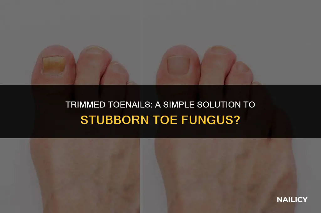 does filing nails down help get rid of toe fungus