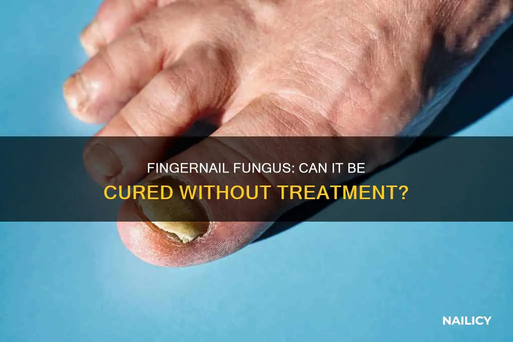 does finger nail fungus go away on its own