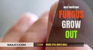 Fungal Fingernails: Can You Outgrow Nail Fungus?