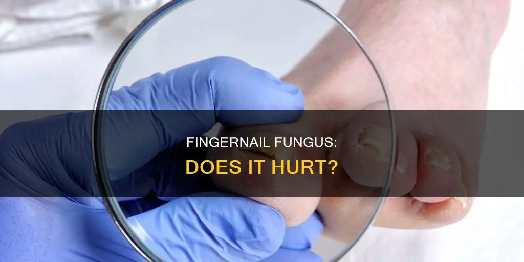 does finger nail fungus hurt
