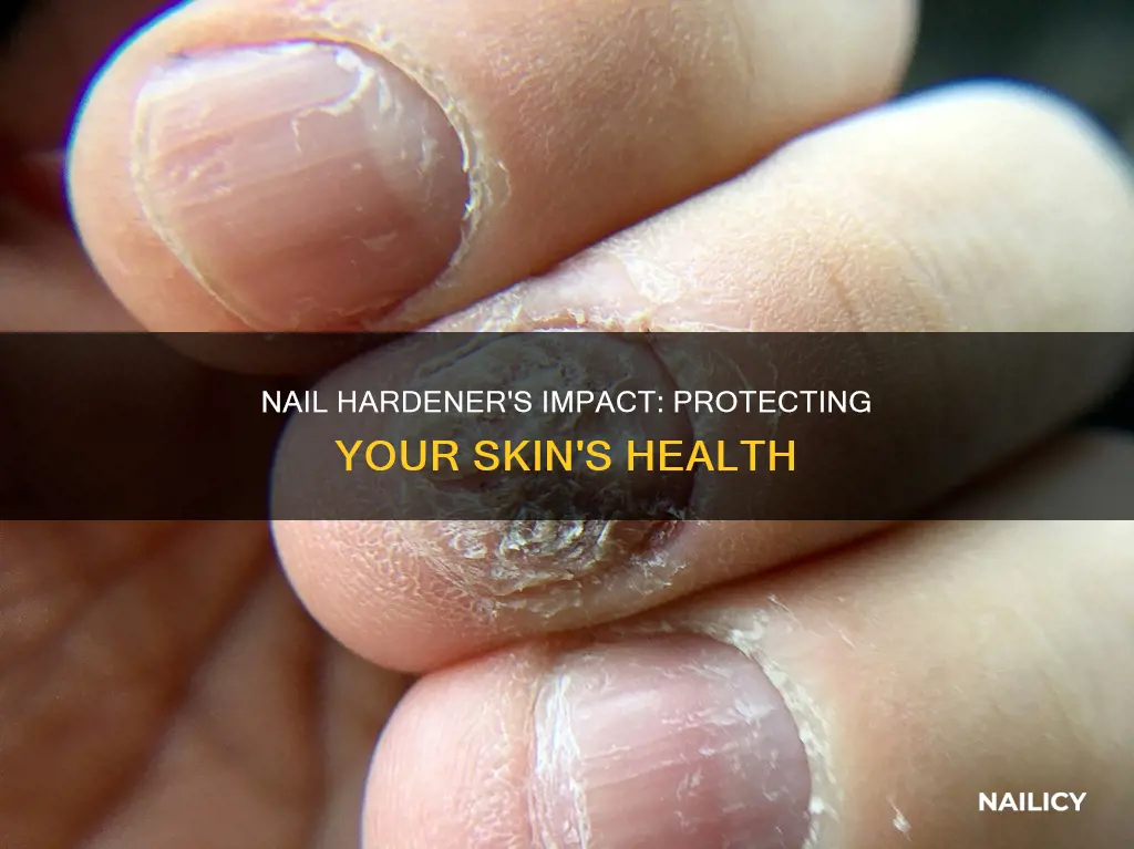 does finger nail hardner hurt your skin