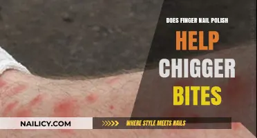 Can Nail Polish Soothe Chigger Bites? A Surprising Home Remedy