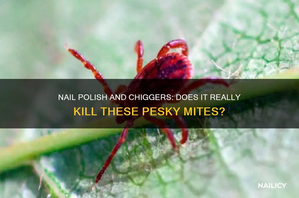 does finger nail polish kill chiggers