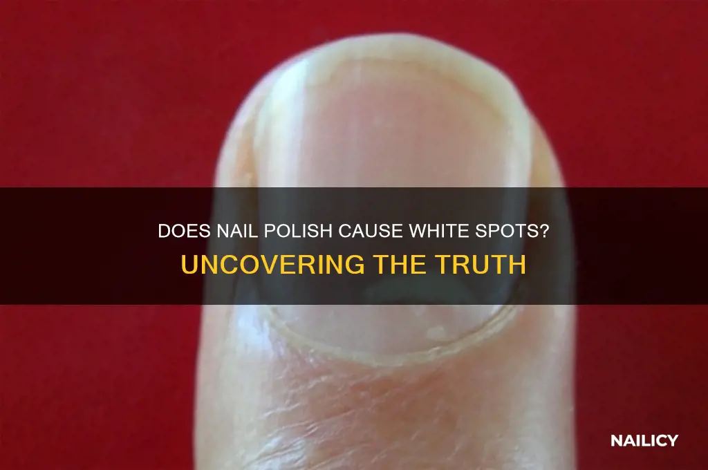 does fingernail polish cause white spots on nails