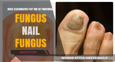 Combatting Nail Fungus: Fluconazole's Effectiveness Revealed