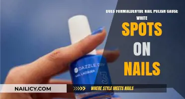 Formaldehyde in Nail Polish: Cause of White Spots on Nails?