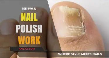 Fungal Nail Polish: Effective Treatment or Just a Temporary Fix?