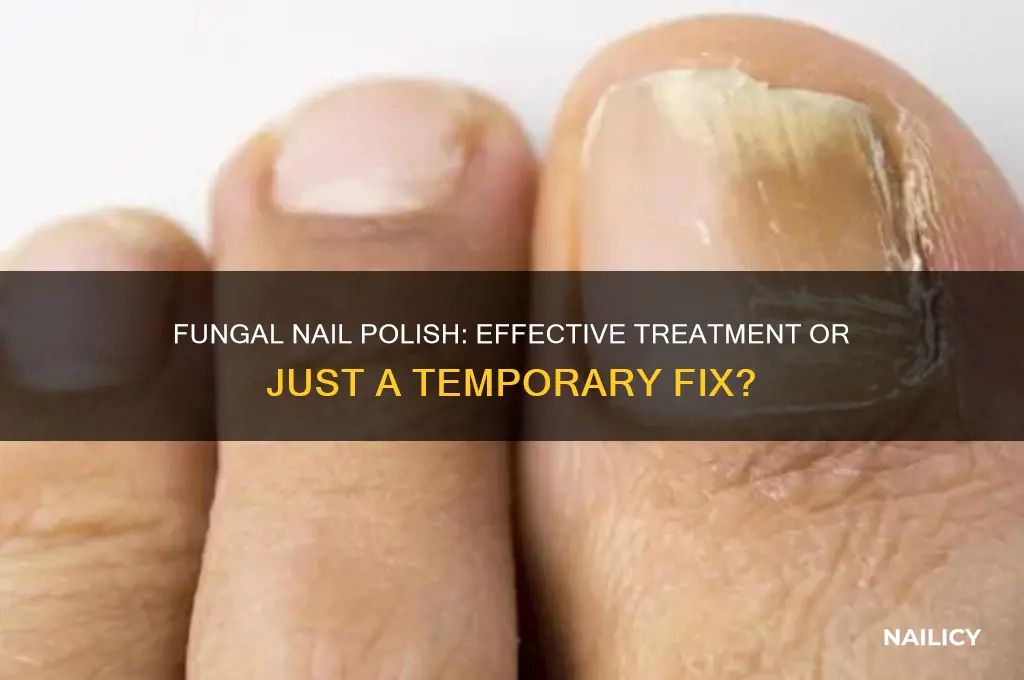 does fungal nail polish work