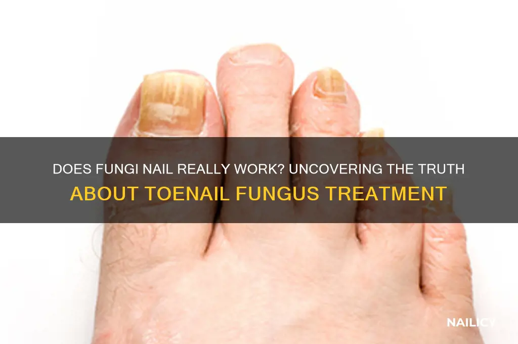 does fungi nail actually work