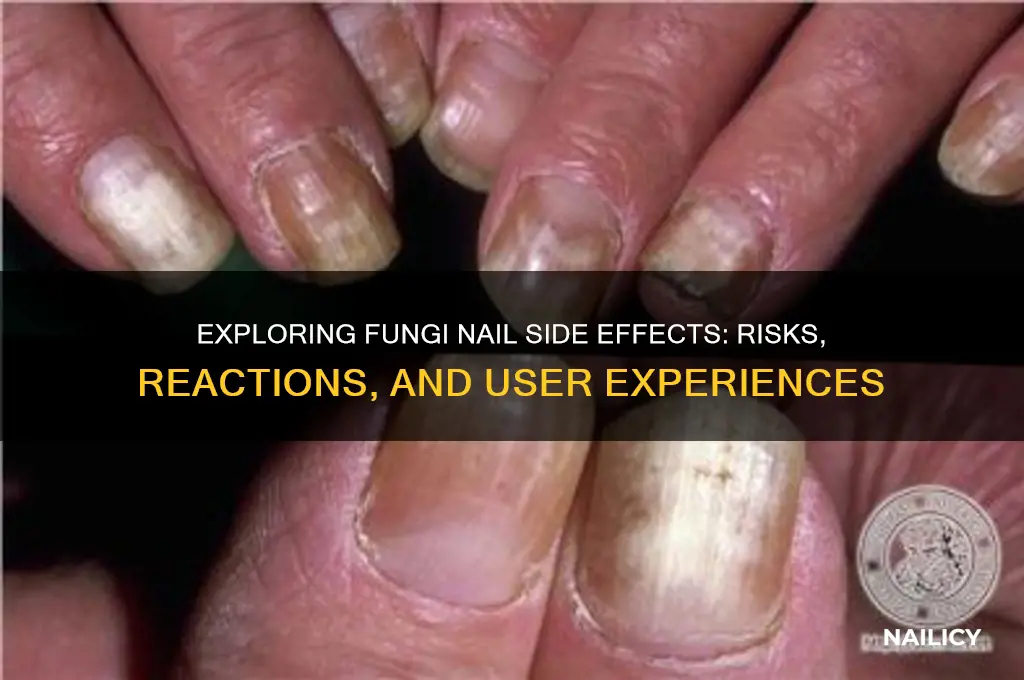 does fungi nail have any side effects