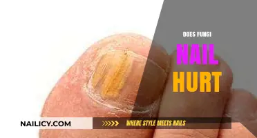 Does Fungi Nail Treatment Cause Pain? A Comprehensive Guide